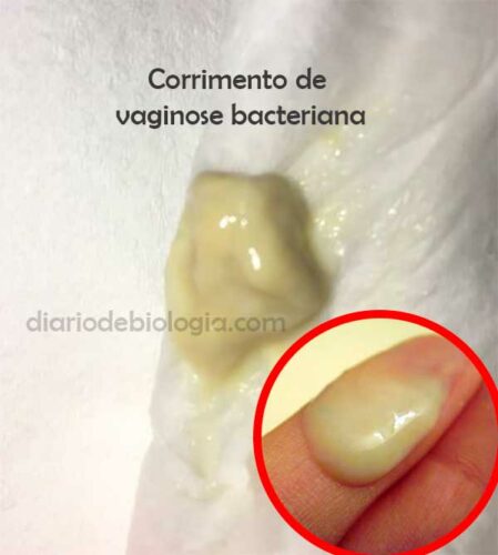 Coceira Na Vagina Analise Seus Sintomas E Veja O Melhor Tratamento Di Rio De Biologia