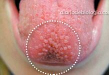 bolinhas na língua